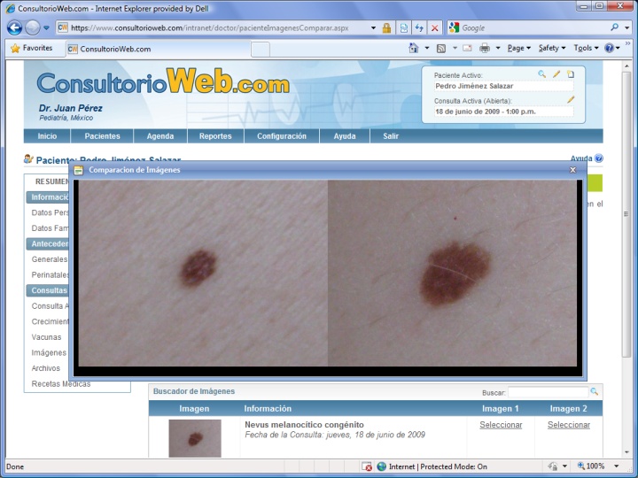 ConsultorioWeb.com le permite comparar imágenes del paciente de una misma consulta o de consultas anteriores.